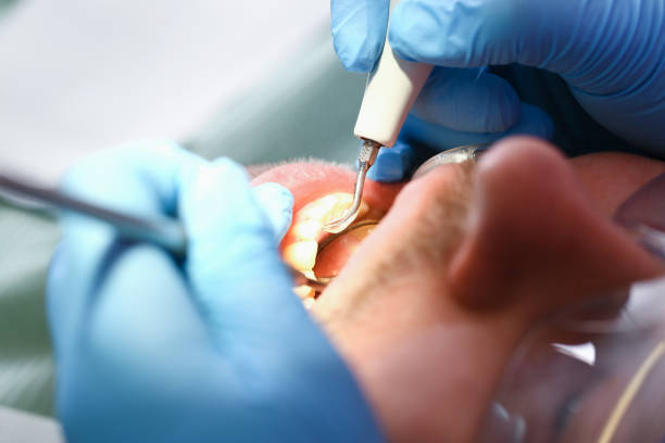 Best Emergency Treatment for Toothache in Slaughterville, OK